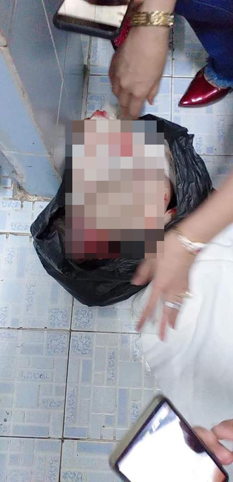Cháu bé tử vong trong thùng rác là do mẹ đẻ dùng dây vải siết cổ - Ảnh 1.