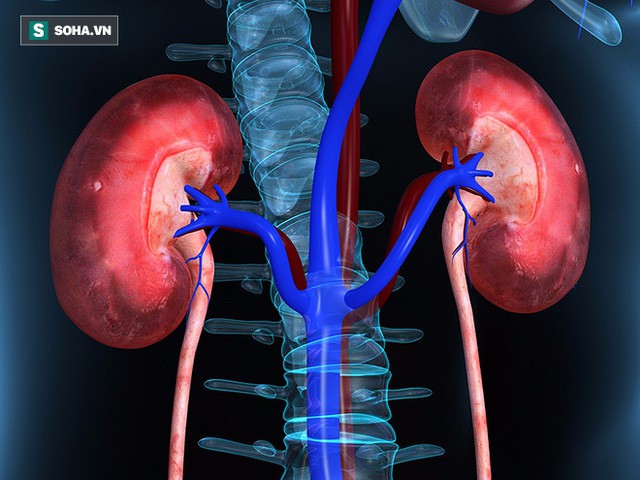 BS cảnh báo: Tỉ lệ mắc bệnh thận mãn tính có xu hướng tăng cao, 4 nhóm người nên đi khám - Ảnh 2.