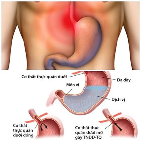 Căn bệnh khiến 7 triệu người khổ sở về đêm - Ảnh 1.