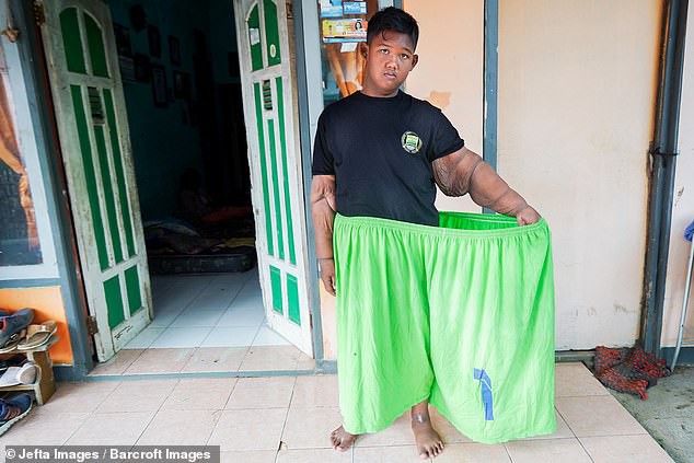 Từng được coi là ‘bé trai nặng nhất thế giới’, cậu bé Indonesia béo đến không thể đi học nổi giờ ra sao - Ảnh 6.