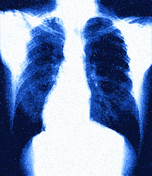 Giải mã bí ẩn cơ thể người: Lá phổi cũng chỉ như cái xô chứa đầy máu - Ảnh 1.