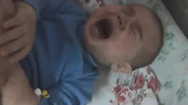 Đưa con trai 10 tháng tuổi đến bệnh viện điều trị bệnh hô hấp, bố mẹ đau đớn thấy cơ thể con bị hủy hoại vì sai lầm khủng khiếp của y tá - Ảnh 2. Đưa con trai 10 tháng tuổi đến bệnh viện điều trị bệnh hô hấp, bố mẹ đau đớn thấy cơ thể con bị hủy hoại vì sai lầm khủng khiếp của y tá - Ảnh 2.