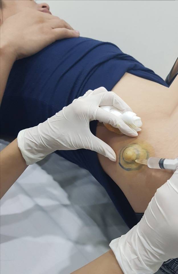 Mổ tay, mổ chân đến mổ u cũng không kêu nhưng Minh Tiệp lại có nỗi sợ thua cả chị em phụ nữ này - Ảnh 2. Mổ tay, mổ chân đến mổ u cũng không kêu nhưng Minh Tiệp lại có nỗi sợ thua cả chị em phụ nữ này - Ảnh 2.