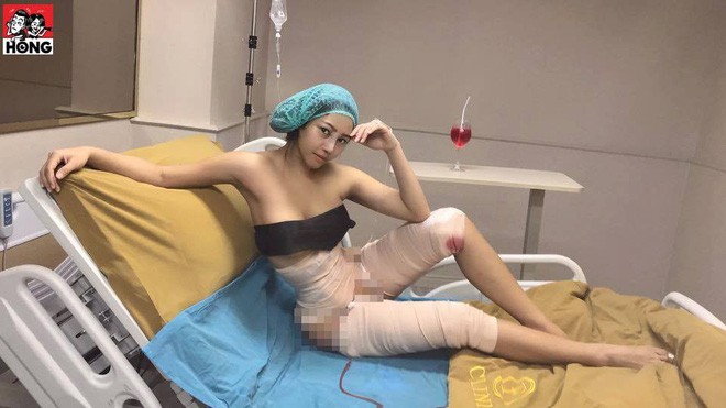 Hot girl bốc lửa Thái Lan bất ngờ công khai ảnh phẫu thuật để có eo con kiến, điều đáng nói đây không phải lần đầu cô lột xác - Ảnh 2.