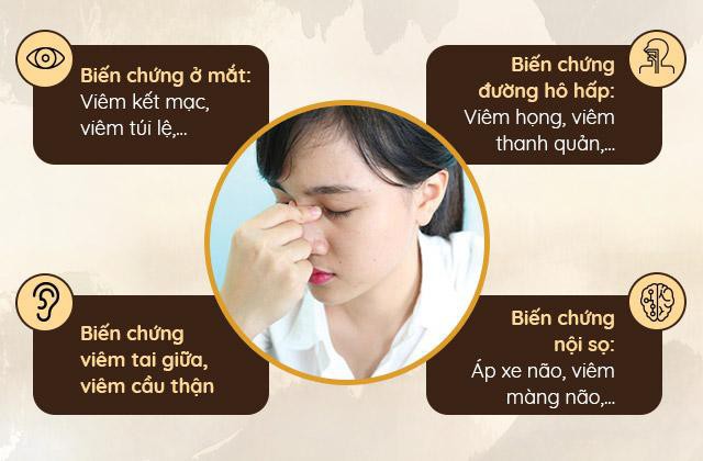 Bệnh viêm xoang mũi: Triệu chứng, cách chữa hiệu quả không kháng sinh - Ảnh 2.