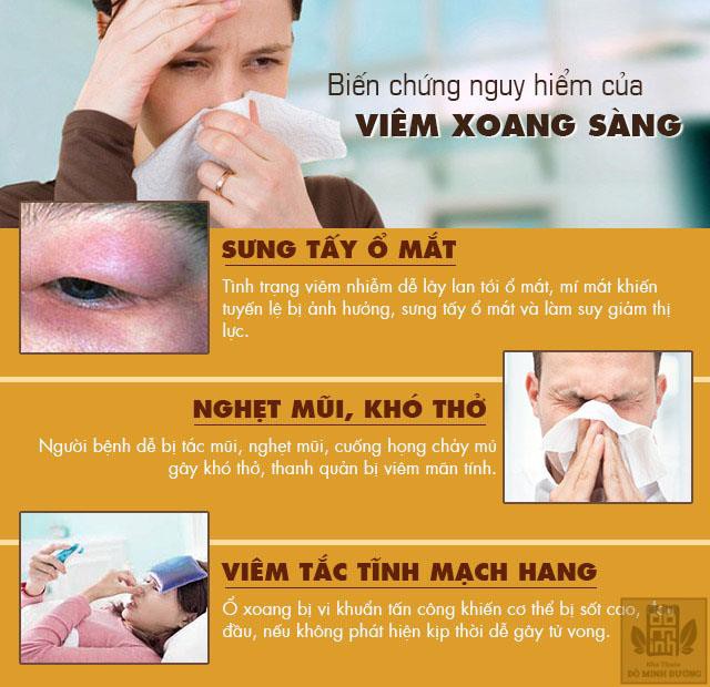 Bệnh viêm xoang sàng trước, sau: Dấu hiệu và cách chữa hiệu quả - Ảnh 2.