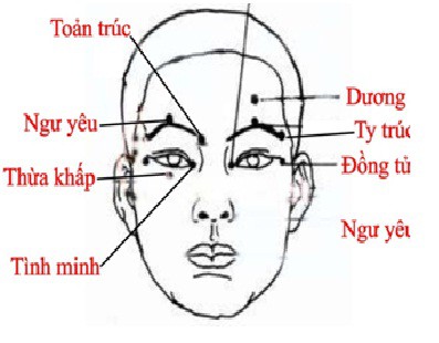 Trị chắp, lẹo bằng châm cứu - Ảnh 1.