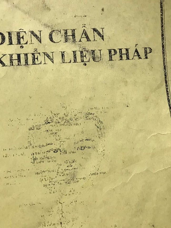 Sau nửa năm điều trị chứng xuất huyết não, bệnh tình của diễn viên Thúy Anh giờ ra sao? - Ảnh 1.