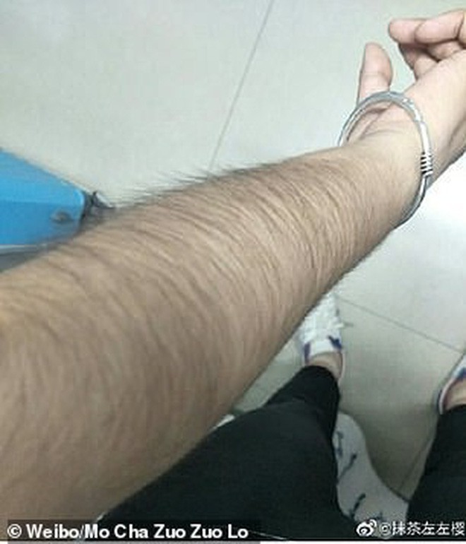 Các thiếu nữ Trung Quốc rộ trào lưu khoe lông tay, lông chân dày đến mức muỗi cũng không đốt nổi - Ảnh 6.