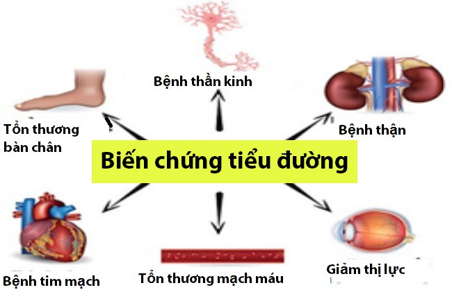 Khả năng hạ đường huyết vượt trội của cây thìa canh lá to - Ảnh 1.