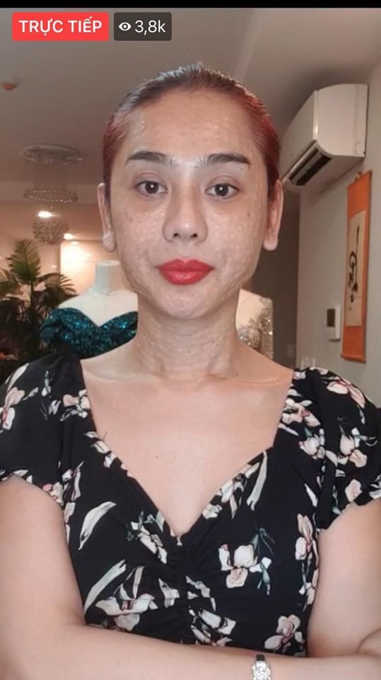 Nhan sắc xuống cấp, lộ da mặt sần sùi sau 7 năm phẫu thuật chuyển giới của Lâm Khánh Chi - Ảnh 1.