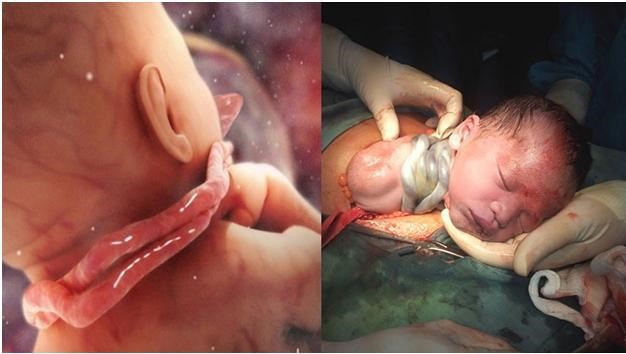 Mẹ bầu 39 tuần kiên quyết sinh mổ dù mẹ chồng phản đối, lúc lấy thai nhi ra bác sĩ toát mồ hôi vì sợ hãi - Ảnh 1. Mẹ bầu 39 tuần kiên quyết sinh mổ dù mẹ chồng phản đối, lúc lấy thai nhi ra bác sĩ toát mồ hôi vì sợ hãi - Ảnh 1.