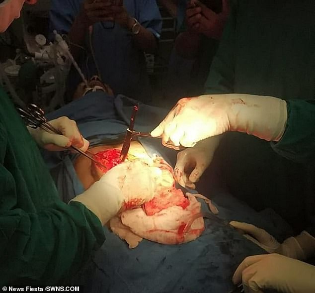 Ca phẫu thuật kinh hoàng gây sốc: Cả rổ kim loại trong bụng bệnh nhân vì căn bệnh lạ - Ảnh 2.