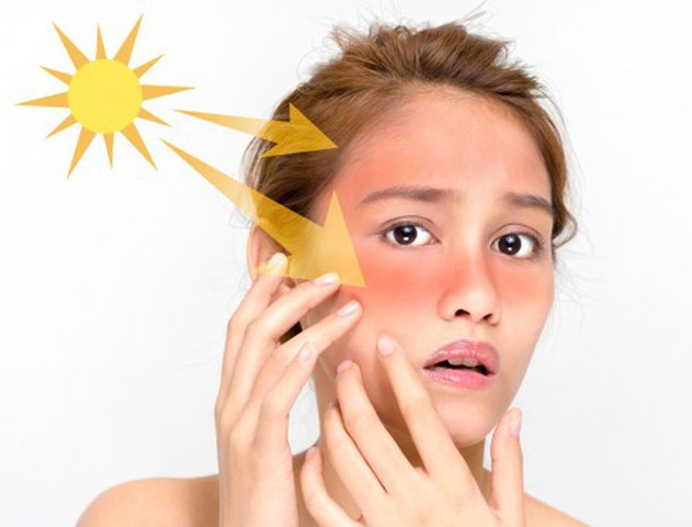 Hôm nay, cảnh báo tia UV nguy cơ gây hại cao khi tiếp xúc trực tiếp ánh nắng - Ảnh 1.