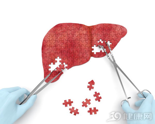 6 nhóm người có nguy cơ cao bị gan nhiễm mỡ: Cần điều chỉnh ngay trước khi quá muộn - Ảnh 1.