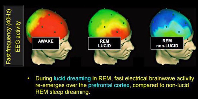 Đây là 3 phương pháp khoa học giúp bạn có được giấc mơ Lucid - Ảnh 2.