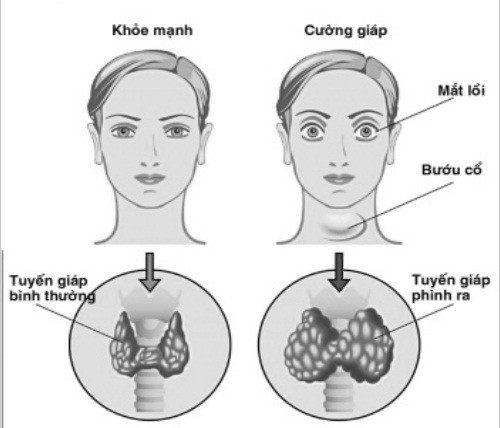 I-ốt quan trọng thế nào với sức khỏe? - Ảnh 1.