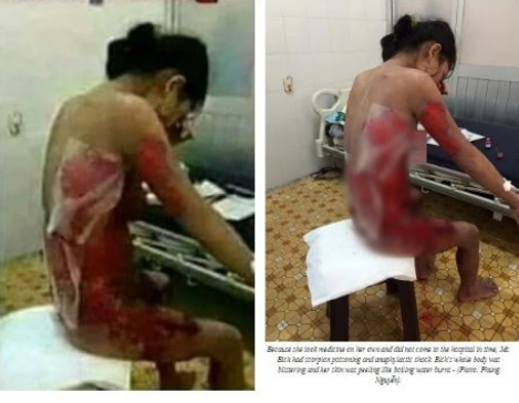 MXH nước ngoài lan truyền hình ảnh người phụ nữ bị bạo hành thương tâm nhưng đó lại là một cô gái Việt Nam và sự thật câu chuyện hoàn toàn khác - Ảnh 2.