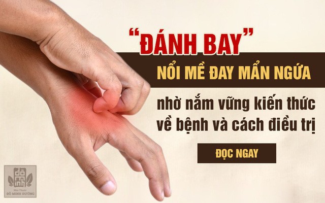 Nổi mề đay mẩn ngứa: Triệu chứng và cách chữa trị hết dị ứng, nổi mẩn đỏ - Ảnh 1.