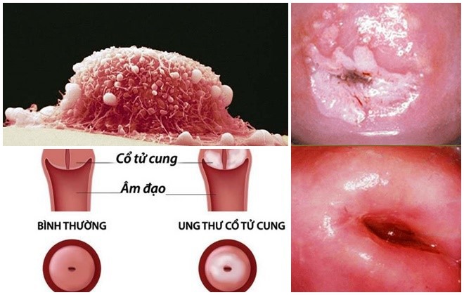 Căn bệnh ung thư đang trẻ hoá đáng sợ: Lời cảnh báo cho các vị phụ huynh - Ảnh 1.