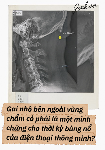 Đọc cuối tuần: Từ một con dê khuyết tật cho đến những bí ẩn trong bộ xương người - Ảnh 9.