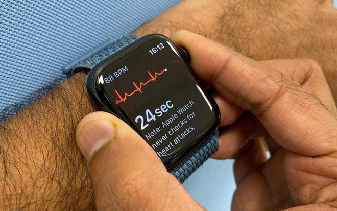 Bác sỹ tim mạch kiện Apple “ăn cắp” bằng sáng chế phát hiện nhịp tim bất thường, tính năng đã làm lên thương hiệu của Apple Watch - Ảnh 2.