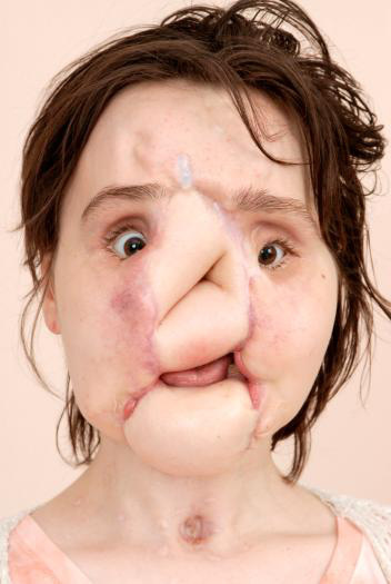 Hành trình của người phụ nữ trẻ nhất thế giới được cấy ghép khuôn mặt từ người hiến tặng và cuộc chiến với tử thần kéo dài 31 tiếng - Ảnh 7.