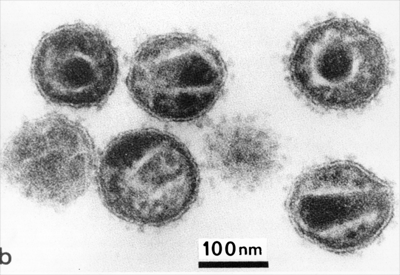 Những sự thật ít người biết về virus: Chúng đến từ đâu, lây lan và gây bệnh như thế nào? - Ảnh 1.