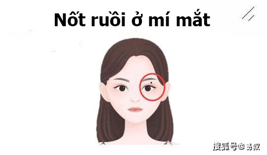 Phụ nữ sở hữu nốt ruồi ở những chỗ này trên gương mặt, 10 người hết 9 người giàu có phú quý, càng lớn tuổi càng nhiều tiền - Ảnh 2.