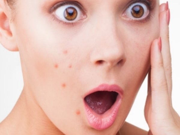 Những dấu hiệu chứng tỏ bạn ăn quá nhiều đường - Ảnh 6. Những dấu hiệu chứng tỏ bạn ăn quá nhiều đường - Ảnh 6.