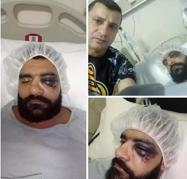 Lực sĩ Ai Cập bị đấm tím mắt, nhập viện khẩn cấp sau 8 giây vì trận đấu khó tin - Ảnh 2.