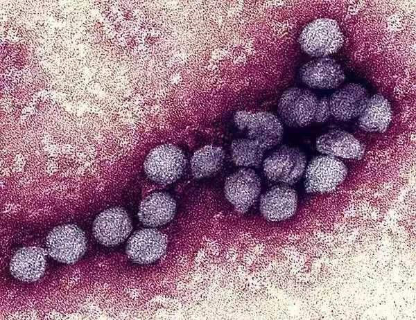 Thợ săn Virus: Những người đầu tiên tìm ra danh tính virus lạ, luôn phải đối mặt với sự nguy hiểm và hàng loạt áp lực từ công chúng - Ảnh 3.