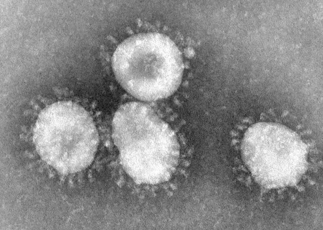 Thợ săn Virus: Những người đầu tiên tìm ra danh tính virus lạ, luôn phải đối mặt với sự nguy hiểm và hàng loạt áp lực từ công chúng - Ảnh 7.