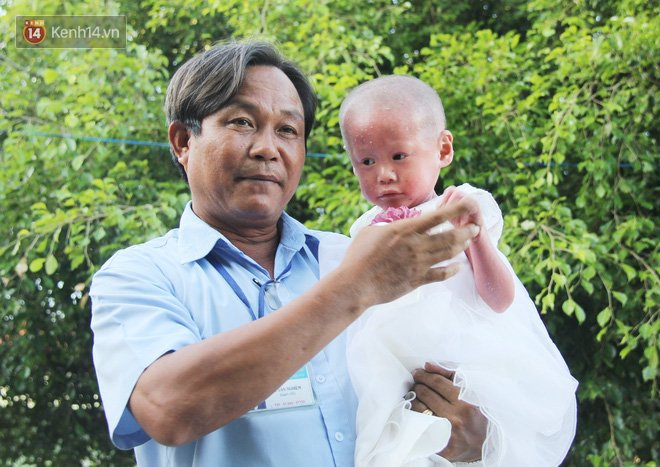 Cuộc sống hiện tại của em bé người đầy vẩy ngứa như da trăn, bị bố mẹ bỏ rơi trong bệnh viện - Ảnh 4.