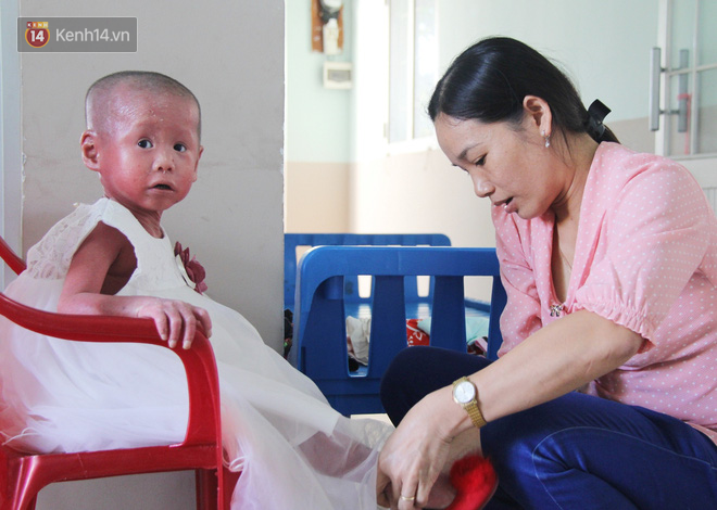 Cuộc sống hiện tại của em bé người đầy vẩy ngứa như da trăn, bị bố mẹ bỏ rơi trong bệnh viện - Ảnh 7.