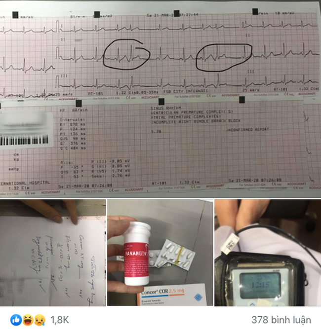 Cô gái than thở cứ gặp người yêu là con tim loạn nhịp, phải đeo máy đo nhịp tim suốt 24h, bất ngờ nhất là phản ứng của cư dân mạng - Ảnh 2.