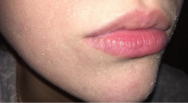 Bổ sung vitamin A ngay nếu cơ thể bạn xuất hiện 7 dấu hiệu này - Ảnh 1. Bổ sung vitamin A ngay nếu cơ thể bạn xuất hiện 7 dấu hiệu này - Ảnh 1.