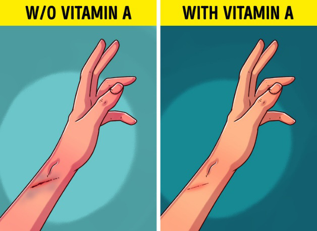 Bổ sung vitamin A ngay nếu cơ thể bạn xuất hiện 7 dấu hiệu này - Ảnh 5.