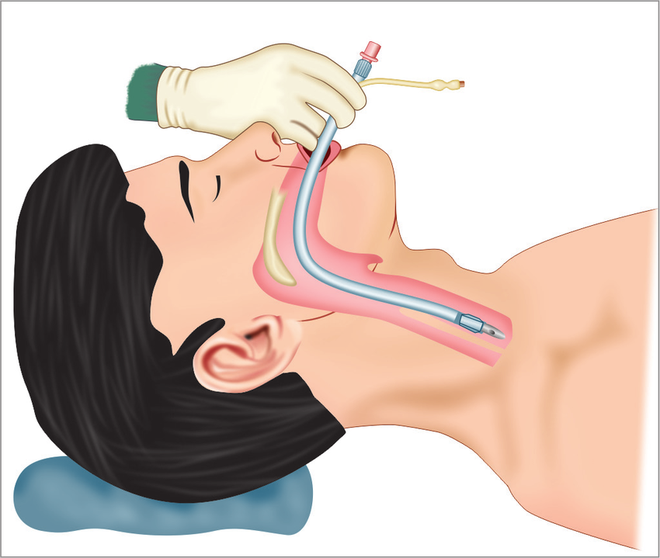 Bác sĩ Anh giải thích chuyện gì xảy ra trong phòng chăm sóc tích cực và nhắc nhở về thứ quyền năng hơn để cứu bệnh nhân Covid-19 - Ảnh 3.