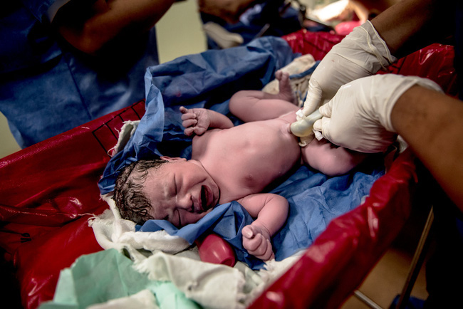 Nỗi khổ của thai phụ ở Venezuela: Hành trình vượt cạn tử thần hành hạ thân xác, đến bệnh viện nào cũng bị từ chối và những cái chết trở thành bí mật - Ảnh 8.