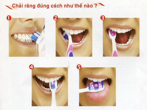 7 thói quen xấu thường gặp khi vệ sinh răng - Ảnh 1.