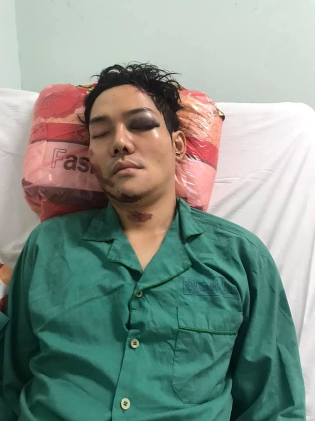 Sau tai nạn nghiêm trọng, con trai nuôi nghệ sĩ Hoài Linh phẫu thuật nối xương hàm bị gãy đôi vào sáng nay - Ảnh 1.