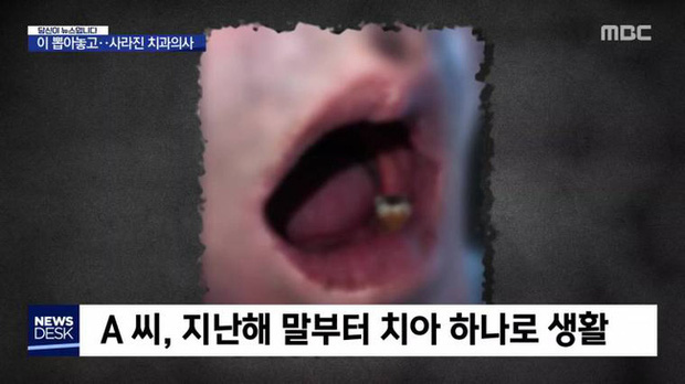 Tin nhầm lang băm, người đàn ông bị nhổ hết 15 chiếc răng trước khi bệnh viện đóng cửa và bác sĩ biến mất - Ảnh 2.