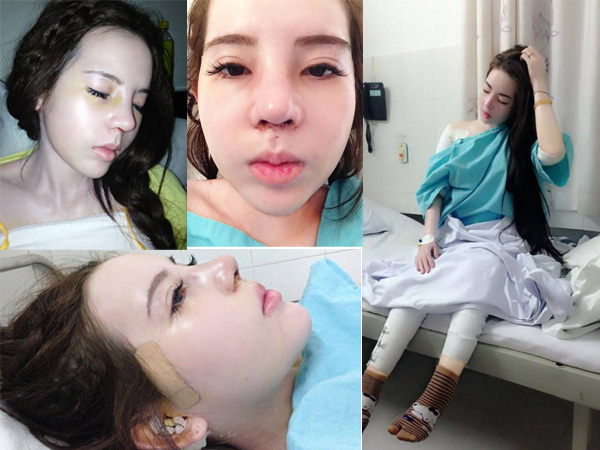 Mẹ Việt 2 con chi gần 1 tỷ đồng cho 8 cuộc phẫu thuật nâng cấp dung mạo, được trang báo Hàn đình đám Dispatch đưa lên trang nhất và gọi là nữ thần - Ảnh 9.