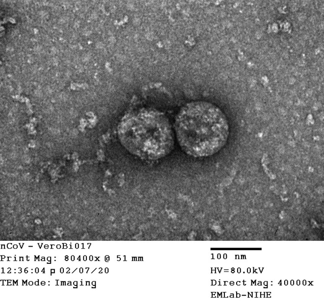 PGS.TS Lê Quỳnh Mai: Virus SARS-CoV-2 tại Việt Nam đã biến đổi thành 2 nhóm khác hẳn nhau - Ảnh 1.