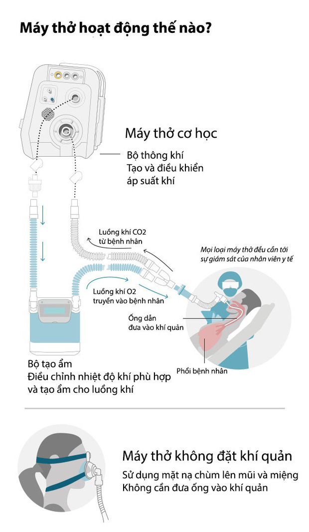 Chuyên gia phân tích: Máy thở và máy thở không xâm nhập có công dụng thế nào trong việc điều trị Covid-19? - Ảnh 2.