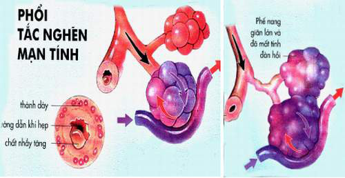 Những căn bệnh phụ nữ dễ mắc phải hơn nam giới - Ảnh 6.