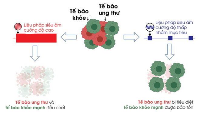 Kỹ thuật siêu âm mới có thể tiêu diệt tế bào ung thư dựa trên hiệu ứng sóng dừng - Ảnh 5.