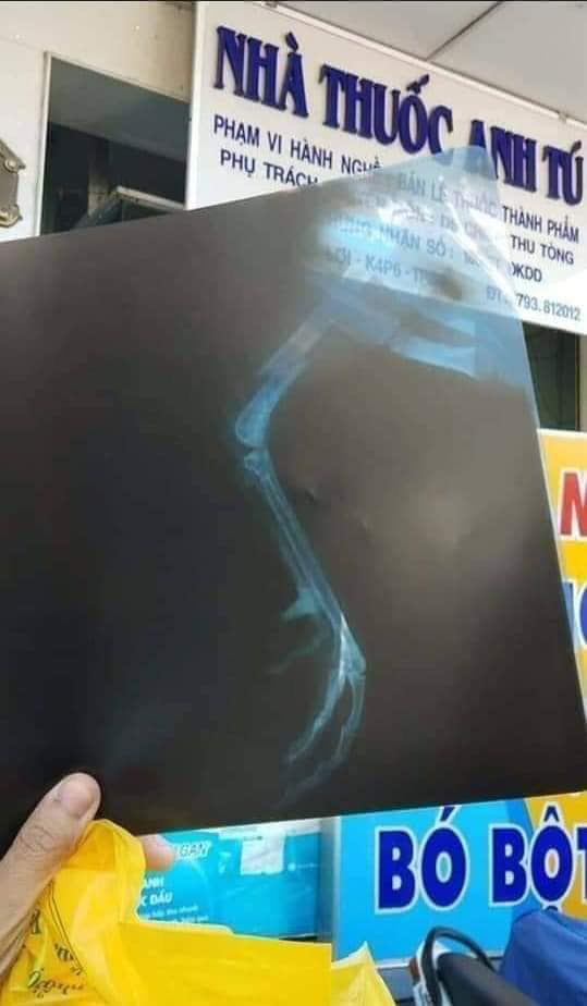 G&agrave; cưng bị g&atilde;y ch&acirc;n, thanh ni&ecirc;n l&agrave;m điều khiến ai nấy đều phải g&atilde;i đầu v&igrave; qu&aacute; kh&oacute; lường - Ảnh 2.