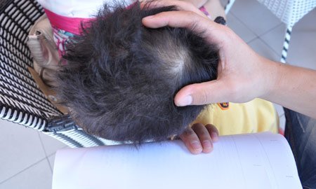 Giáo viên bị tố đánh “chấn động não” bé 3 tuổi 1